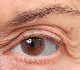 Eyelid Surgery | Eyelid Lift | Oculoplastic Surgery | Marion IL | Dexter MO