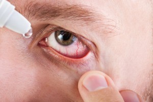 eye diseases